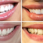 Name That Celebrity Smile